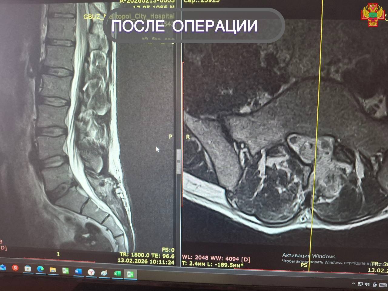 «Новая жизнь без боли»: пациент Мелитопольской областной больницы благодарен нейрохирургам «Новая жизнь без боли»: пациент Мелитопольской областной больницы благодарен нейрохирургам
